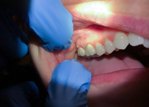 Best Emergency Care for Gum Disease in Colleyville, TX