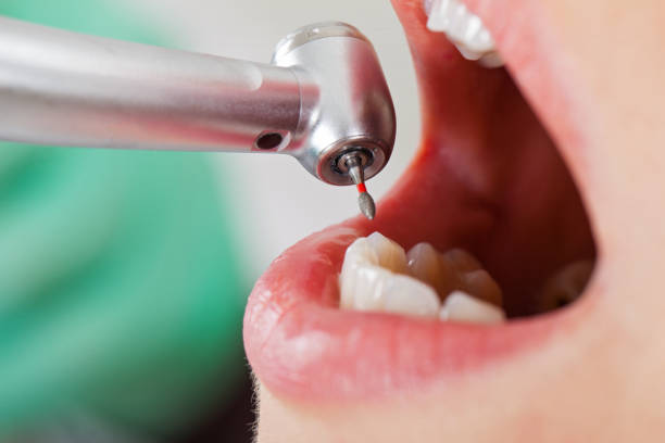 Best Walk-In Emergency Dental Services in Colleyville, TX